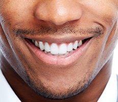 Teeth Whitening